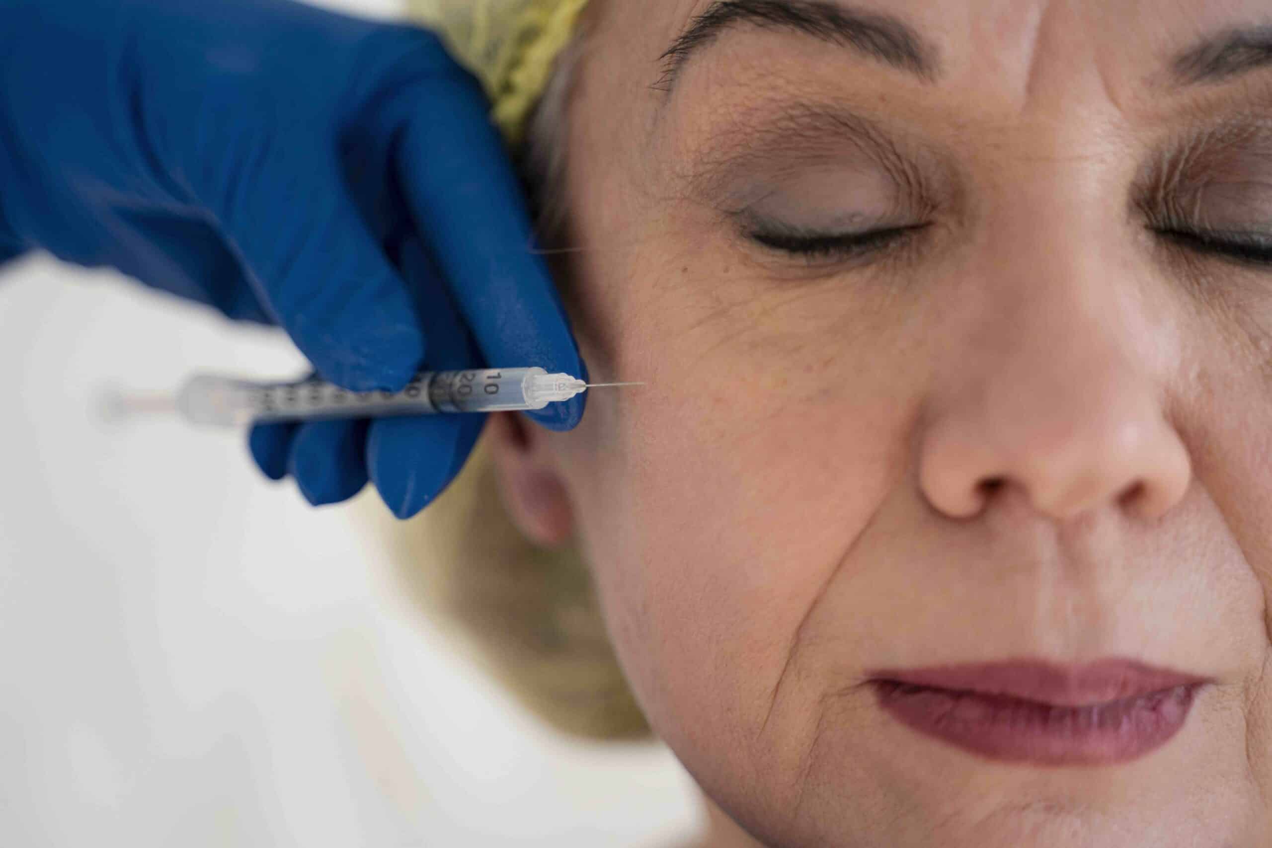 Comment agit la toxine botulique sur le muscle ?